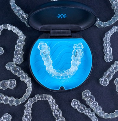 Single aligner in case surrounded by multiple aligners